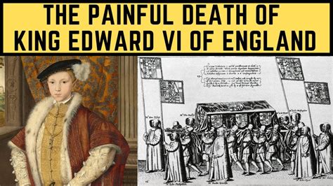 edward tudor illness|how did king edward die.